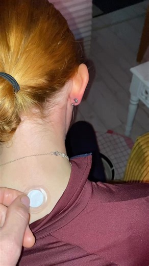 3.4K views |  Wie du das Lichtakupunktur-Pflaster richtig anbringst...