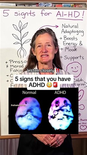 5 Signs You Have ADHD: Recognizing the Symptoms