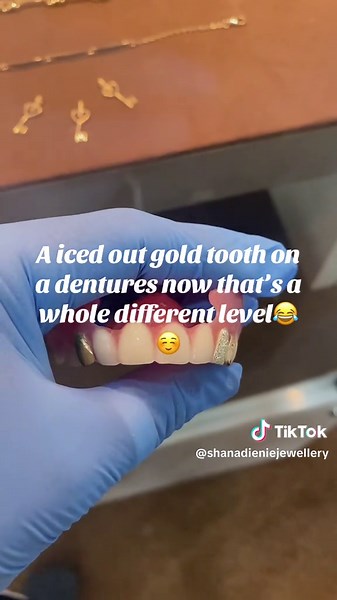 Custom Gold Teeth for Dentures: A Unique Experience