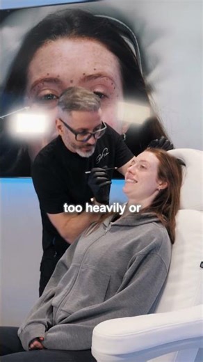 Brow lift injection points