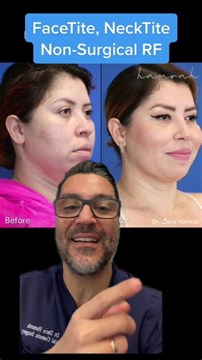 Non-Surgical Face and Neck Tightening Procedures Explained