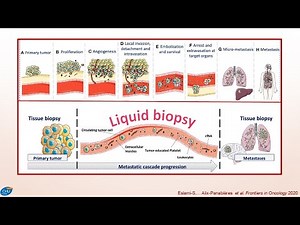 The science and promise of liquid biopsies: improving cancer treatment