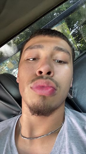 Dealing with Lip Bumps: Causes and Remedies