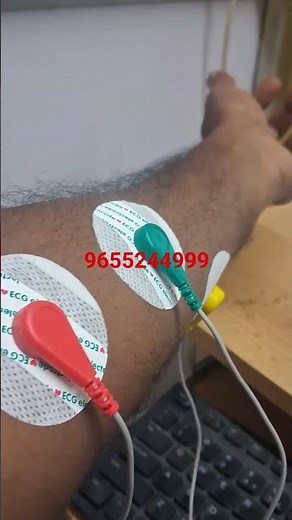 EMG Sensor testing with arduino #esp8266 #electronic #science #arduino #education