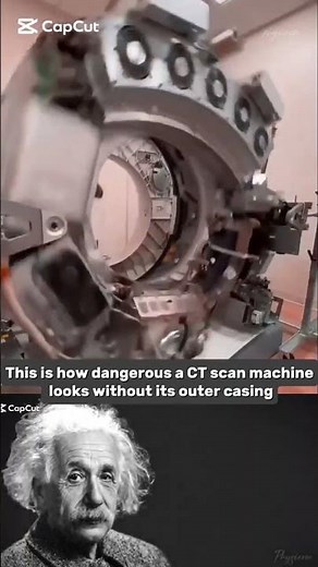 This is how dangerous a CT scan machine looks without its outer casing.😱💥. #shorts #sciecne