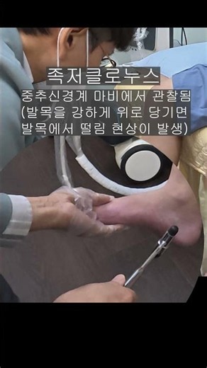 S36 How to Easily Distinguish Between Central and Peripheral Nerve Paralysis