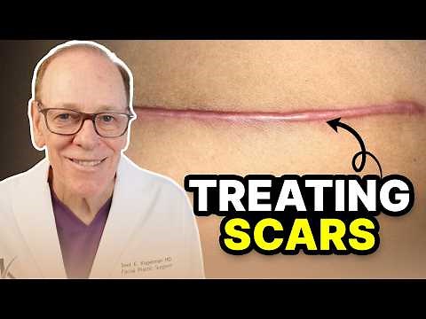 Best Scar Treatments | Plastic Surgeon Advice
