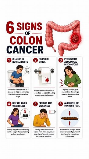 6 Signs of Colon Cancer You Should Never Ignore