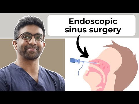 Nasal surgeon explains: What is endoscopic sinus surgery?