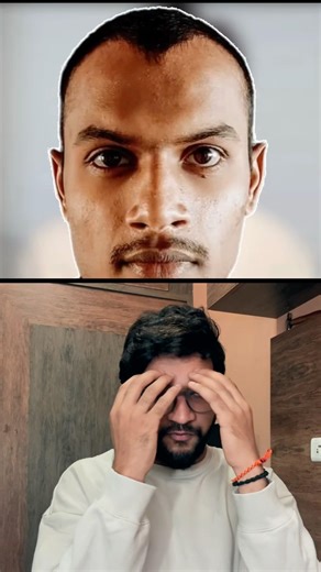 Heart FACE 💟 unnavallaki , BATTA THALA untundi! 😲 #shorts