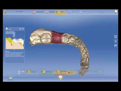 CEREC Guide 2