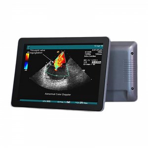 [Hot Item] Android LCD Multi Screen Display Hanging Open House Signs Interactive Advertising Player Rack Digital Signage for Window Shop