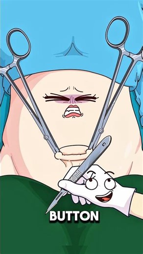 Why Some Womens Get Belly Button Cosmetic Surgery ⚠️..!!#e2dhealth #animation #2dshow #fypシ #health