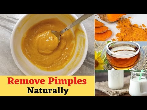 How to Remove Pimples and Dark Spots Naturally (100% Results) | Miss fit fighter
