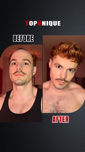 TopUnique on Instagram: "Before & After that speaks for itself 🙌 Our #TUK01 in color #22R gives you the most natural, undetectable look. Realistic hairline, lightweight base, instant confidence boost. Game changer for anyone looking for a flawless hair transformation. link:https://topuniquehair.com/ltfxflnp use code ”EDGAR“ can get 22% discount #hairloss #hairlosstreatment #hairlosshelp bald topuniquehair"