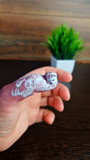 My finger has a large splinter. What should I do?