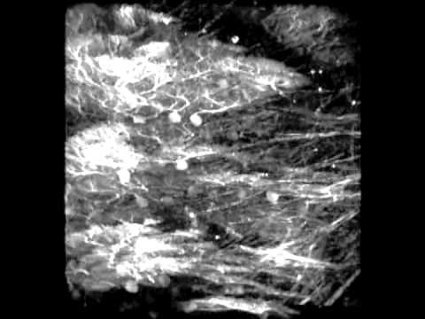 Purkinje Cells of the Cerebellum by Dr. Bernd Kuhn