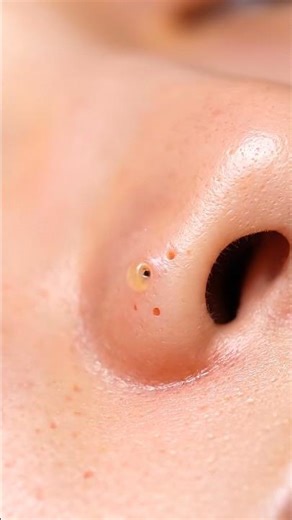 Satisfying Nose Vacuum | Blackhead & Sebum Removal ASMR