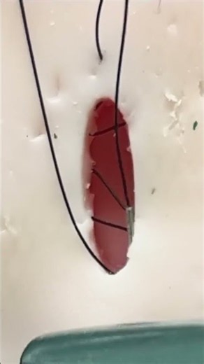 Running subcuticular suture