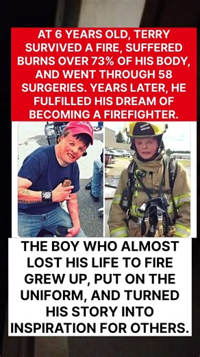 He Survived a Fire at 6 With 73% of His Body Burned, Then Became a Firefighter 🔥❤️