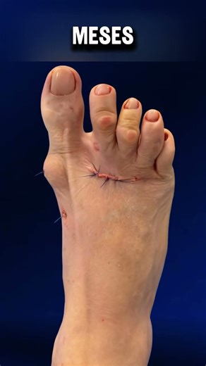 ESTE PIE CAMBIÓ POR COMPLETO EN SOLO 4 MESES 👀