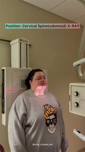 Understanding Cervical Spine Odontoid X-Ray Imaging