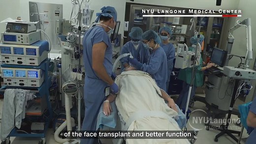 Patrick Hardison's face transplant has given him a new hope for life. He can now walk in crowds without strangers staring and pointing at him. | CNN This Morning