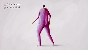 Cervical myelopathy explained | Neurosurgeon Brisbane