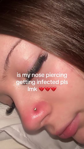 Nose Piercing Infection Signs and Care Tips