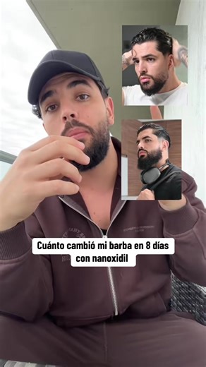 Resultados sorprendentes de crecimiento de barba en 8 días