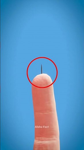 How to remove splinter from fingers 🤌