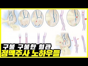 구불구불한 혈관 정맥주사 놓는 법 / IV 정맥주사 노하우 ㅣIV주사놓는법