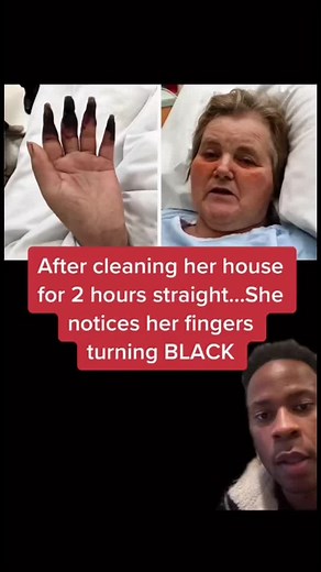 Understanding Gangrene and Its Causes