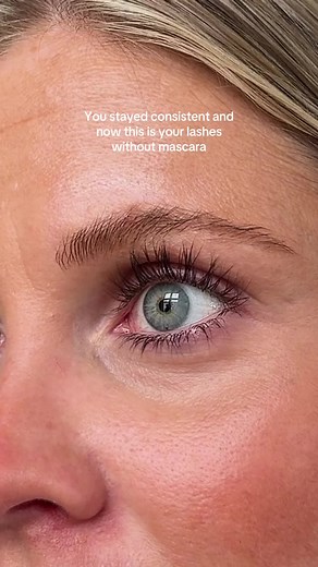 Eyelash Growth Serum: Achieve Stunning Lashes Easily