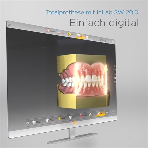 13 reactions | Die aktuelle inLab Software bietet mit der Indikationserweiterung um die Totalprothese einen schnellen, einfachen und wirtschaftlich sinnvollen Einstieg in die digitale Herstellung von Totalprothesen. https://www.dentsplysirona.com/de-de/entdecken/lab/digital-denture.html | Dentsply Sirona | Facebook