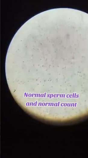 Semen analysis test Normal sperm cell count in microscopy #microscopy #spermcount