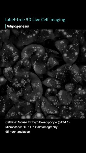 Adipogenesis - Fat Cell Formation
