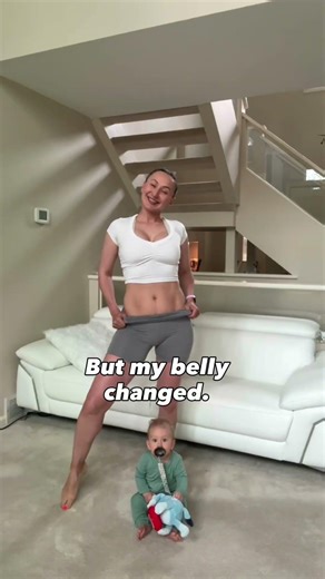 Heal mom pooch by healing diastasis recti in 6 weeks