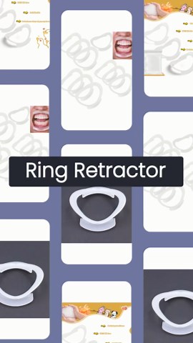 10 Pcs Lip Ring Retractor, Dental Grade Mouth Opener For Speak Out Games, Cheek Expansion Mouthpiece Game Tool For Party Hilarious Family Kids Fun Gaming