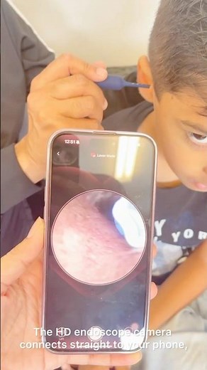 I Put a Camera Inside My Ear… You Won’t Believe What I Found! 👀 | Bebird Earsight Plus