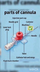 cannula parts .#nurse #anesthesia #medicalstudent