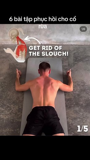 Posture Correcting Exercises for Turtle Neck Relief