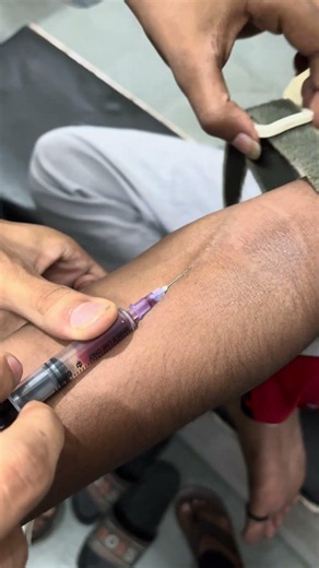 Intravenous Injection Technique Explained |Safe IV Injection Step-by-Step |Nurse GuideClass 38