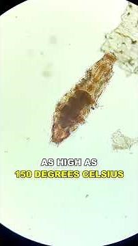 Water Bear | The Most Resilient Animal In The Universe