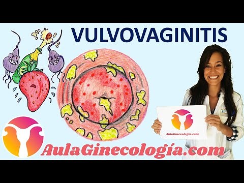 VULVOVAGINITIS: Síntomas, causas, diagnóstico y tratamiento - Ginecología y Obstetricia -