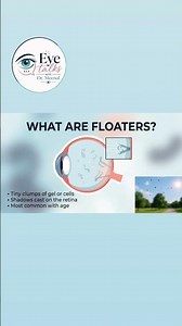 Why Flashing Lights Or Floating "Bugs" In Your Vision Is An Emergency ⚠️🚨#viral #eyes #reels #trend