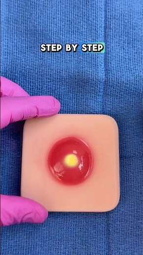 How to Perform an Abscess Incision & Drainage 💯 #clinicalskills #medicaleducation #suturing #shorts