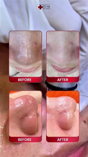 FACIAL ULTIMATE RADIANT GLOW - AQUA GLO