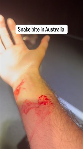 Jaden Klein on Instagram: "A little throw back moment to some kisses 💋 I got during my favorite snake encounter in Australia, a stunning adult diamond python #snakebite #python #australia #australiawildlife"