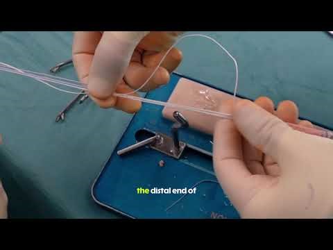 TechTip for ACL Surgery: Lengthening the TightRope System form femoral Fixation